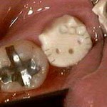tooth